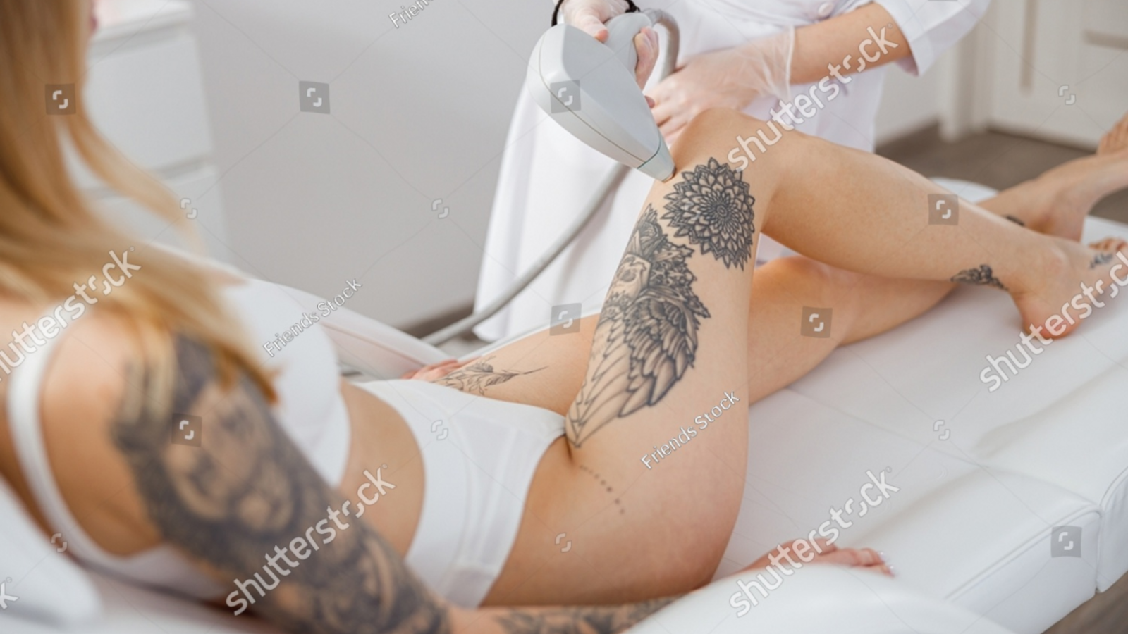 tattoo removal for all skin types
